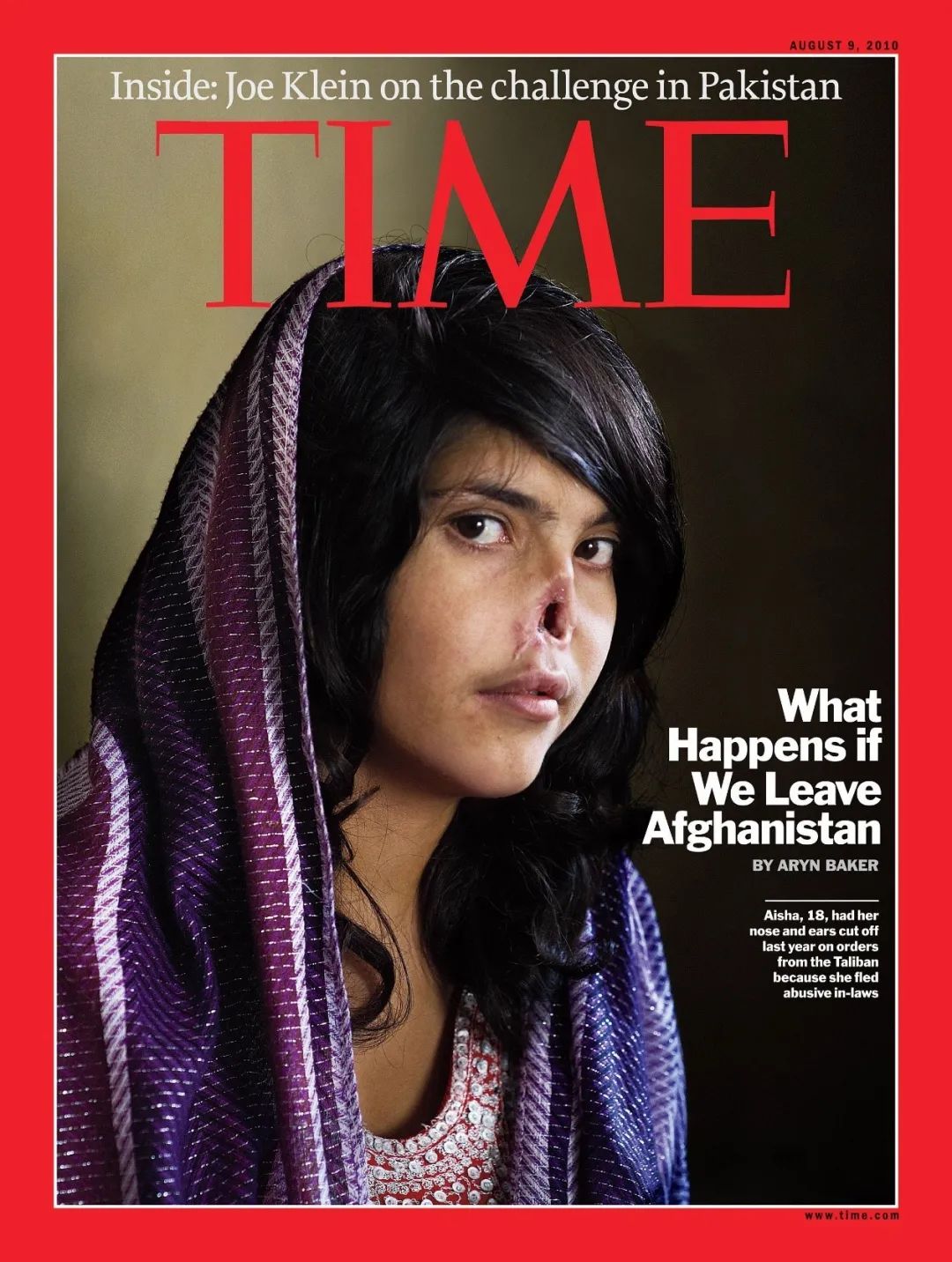 这位28岁的阿富汗女孩被丈夫割下了鼻子和耳朵，但却不敢提及离婚