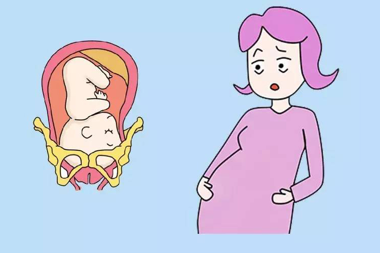 五大迹象告诉你：胎儿入盆是什么感觉？