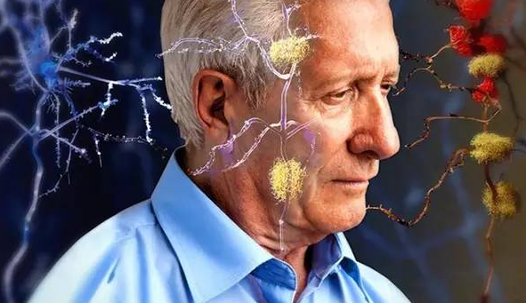 阿尔茨海默病患者数量增加 ，健康生活、锻炼用脑能够很好地预防